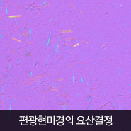 류마잘보는내과 편광현미경으로 본 요산 결정